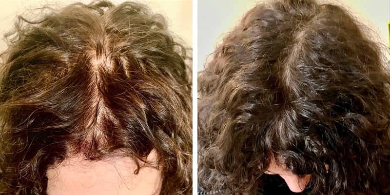 Before and after women&rsquo;s hair loss